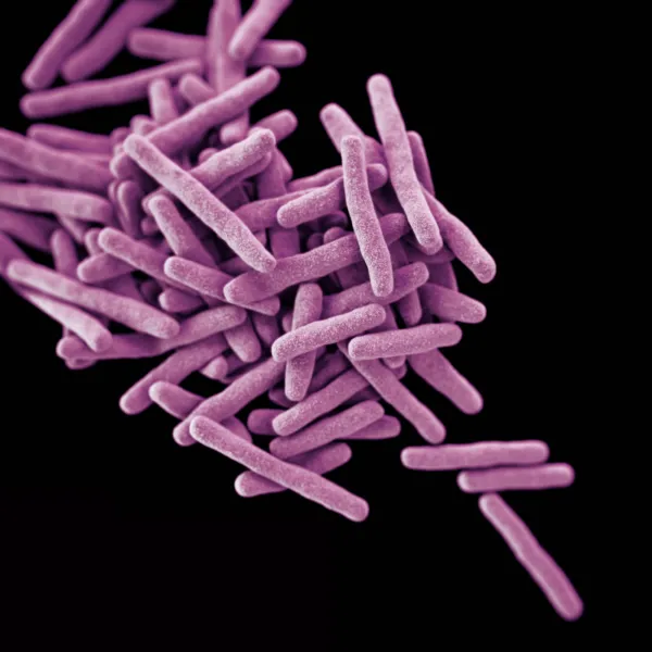 Acid-Fast Bacillus Identification Routine Test